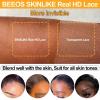 BEEOS Yaki Straight 5×5 SKINLIKE Real HD Lace Closure, Pre-Plucked Bleached Knots Natural Black Human Hair 16 Inch(13×4 HD Lace Frontal-Yaki Straight)