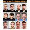 BEEOS 0.10mm PU Skin Toupee for Men, Volume Real Human Hair Mens Hair Piece 130% Medium Density, 8×10 Inch Durable PU Base No Shed Mens Hair Replacement System #613 Blonde(#2 Dark Brown)