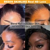 BEEOS Glueless Wigs Human Hair Pre-plucked Pre-Cut 5×5 HD Lace Wig 250% Density Straight Pre Everything Wear and Go Wig Bleached Knots 20 Inch(5×5 Straight Glueless HD Lace Wig 250% Density)